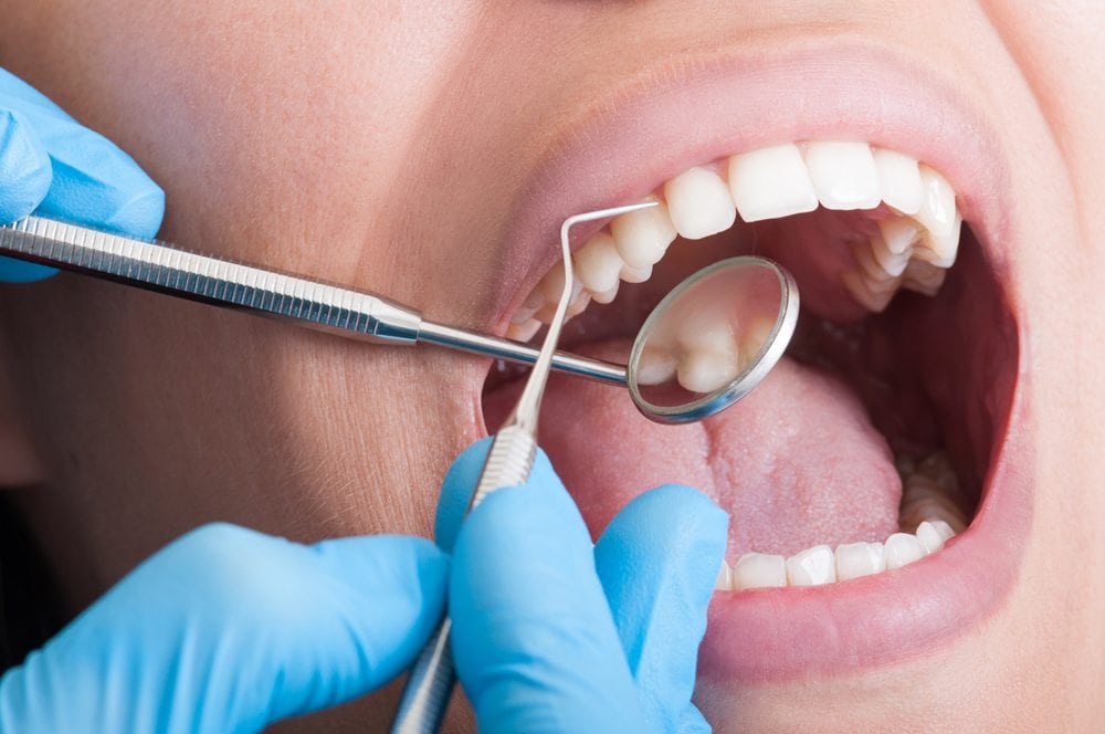 female dental patient getting teeth deep cleaned