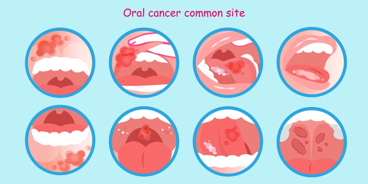 What Tobacco Does to Your Oral Health Birch Point Dental Clinic