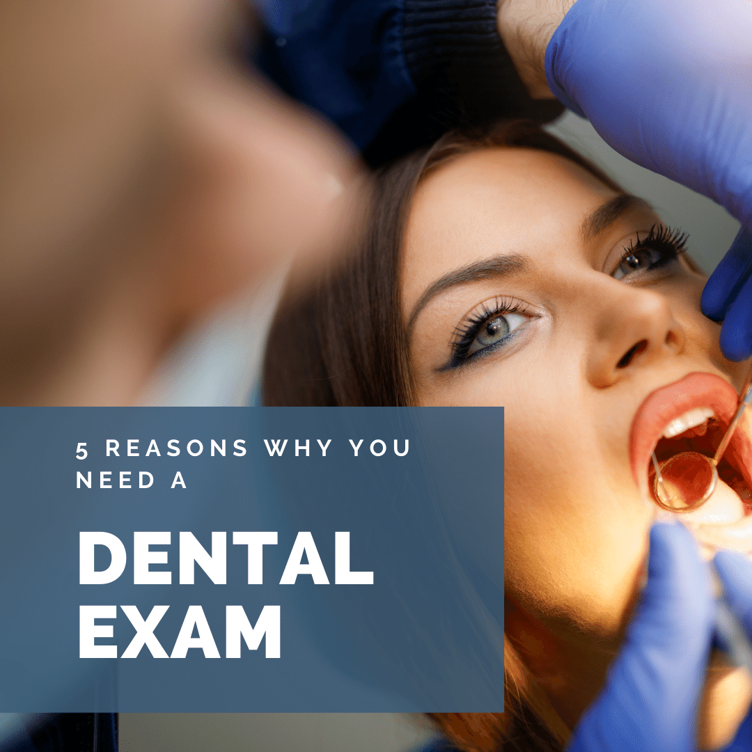 5-reasons-you-need-a-dental-exam-birch-point-dental-clinic-thunder