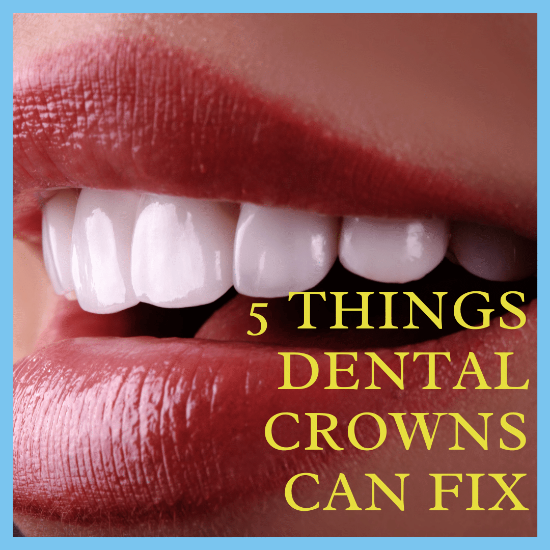 5Things Dental Crowns Can Fix